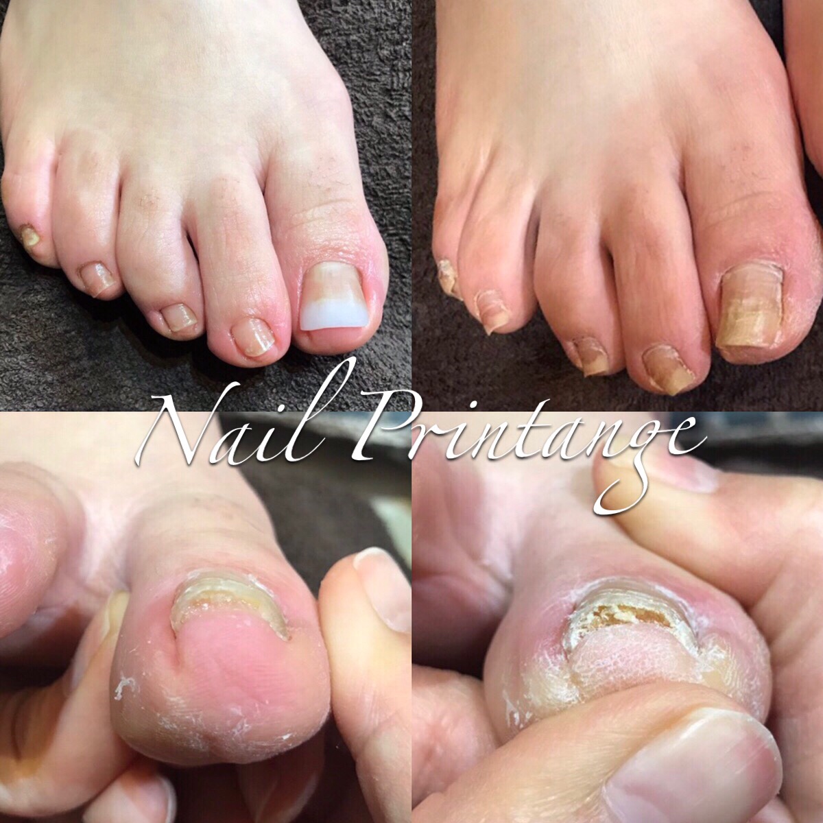 自爪を傷めないネイルサロン 大阪/堀江 Nail＆Foot care Printange ネイル＆フットケア プランタンジュ