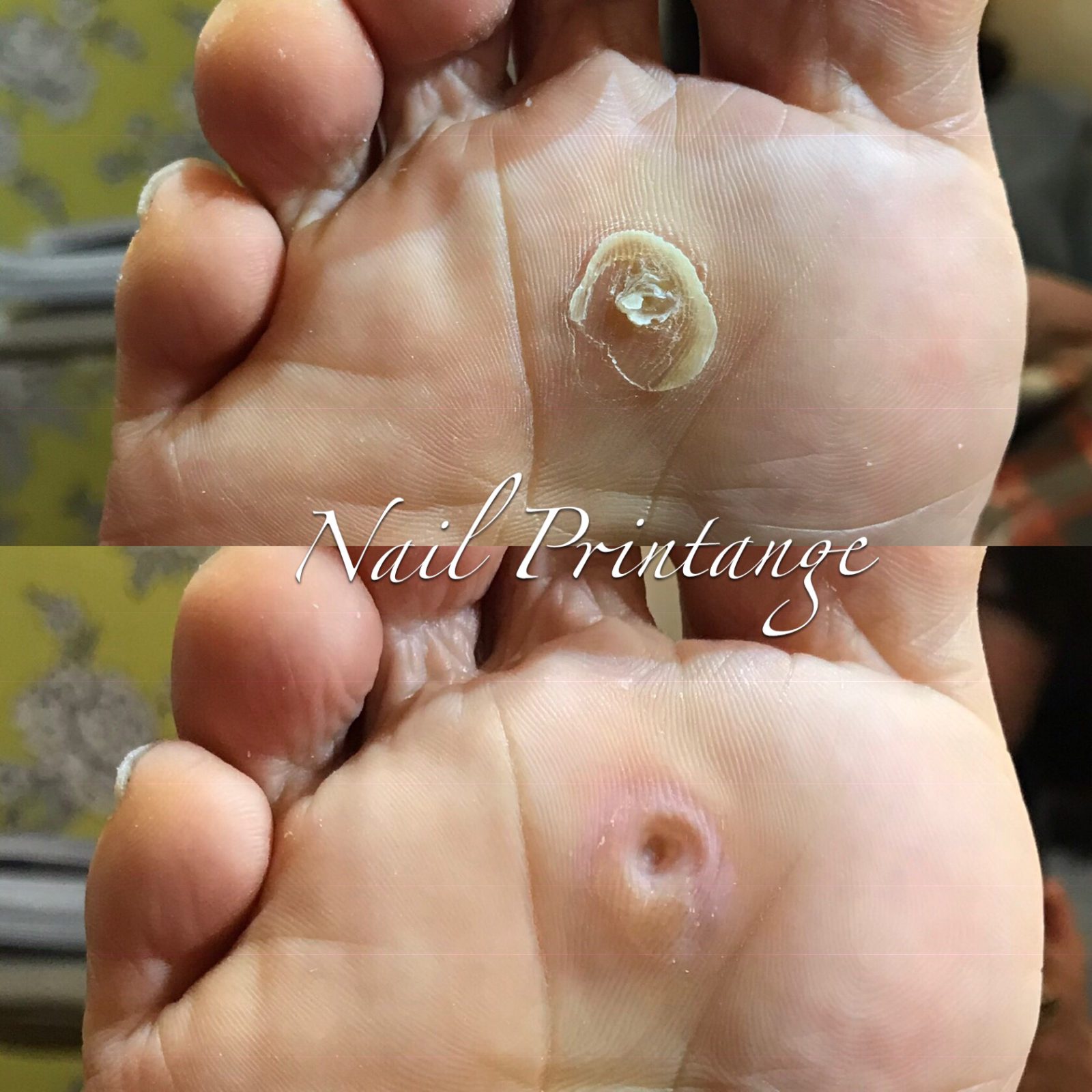 自爪を傷めないネイルサロン 大阪/堀江 Nail＆Foot care Printange ネイル＆フットケア プランタンジュ